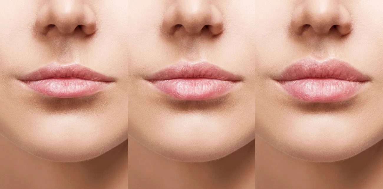 Lip-Plumping